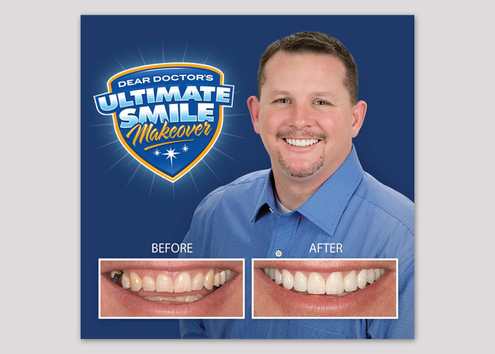 Brian Ultimate Smile Makeover